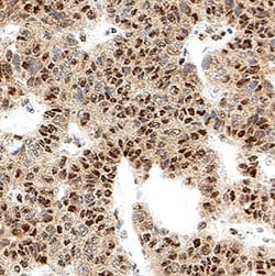 Human Cdk6 Antibody, R D Systems 25 &mu;g; Unconjugated:Antikörper