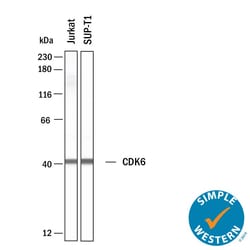 Human Cdk6 Antibody, R D Systems 25 &mu;g; Unconjugated:Antikörper