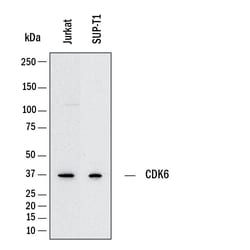 Human Cdk6 Antibody, R D Systems 25 &mu;g; Unconjugated:Antikörper