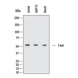 Human T-bet/TBX21 Antibody, R D Systems 100 &mu;g; Unconjugated:Antibodies,