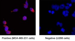 Human uPAR Antibody, R D Systems 100 &mu;g | Buy Online | R&D Systems | Fisher Scientific