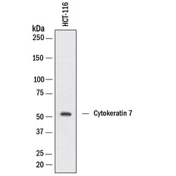 Human Cytokeratin 7 Antibody, R D Systems 25 &mu;g | Buy Online | R&D Systems | Fisher Scientific