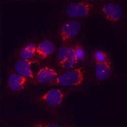 Human Cystatin C Antibody, R D Systems:Antibodies:Primary Antibodies