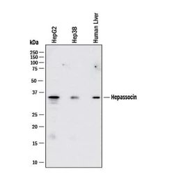 Human Hepassocin/FGL1 Antibody, R D Systems 25 &mu;g; Unconjugated:Antibodies,