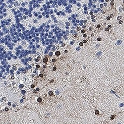 Human S100B Antibody, R D Systems:Antibodies:Primary Antibodies