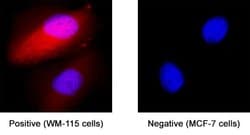 Human S100B Antibody, R D Systems 100 &mu;g; Unconjugated:Antibodies, Monoclonal