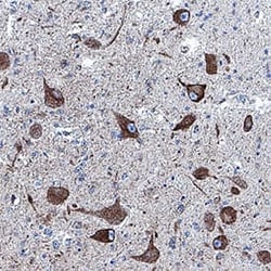 Human TREM2 Antibody, R D Systems:Antibodies:Primary Antibodies