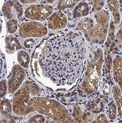 Human BMP-1/PCP Antibody, R D Systems 100 &mu;g | Buy Online | R&D Systems | Fisher Scientific