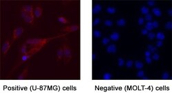 Human G-CSF Antibody, R D Systems 25 &mu;g; Unconjugated:Antibodies, Monoclonal