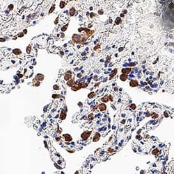 Human G-CSF Antibody, R D Systems 100 &mu;g | Buy Online | R&D Systems | Fisher Scientific