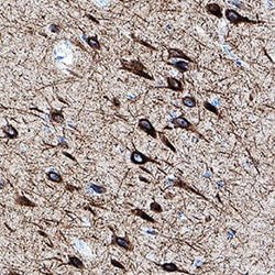 Human NF-L Antibody, R D Systems:Antibodies:Primary Antibodies