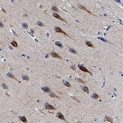 Human NF-L Antibody, R D Systems 100 μg; Unconjugated:Antibodies, Monoclonal
