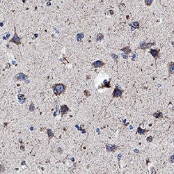 Human LRP-1 Cluster II Antibody, R D Systems 100 &mu;g | Buy Online | R&D Systems | Fisher Scientific