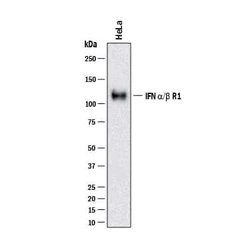 Human IFN-alpha/beta R1 Antibody, R D Systems 25 &mu;g; Unconjugated:Antikörper