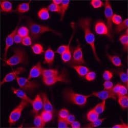 Human IL-15 Antibody, R D Systems:Antibodies:Primary Antibodies