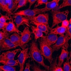 Human IL-15 Antibody, R D Systems:Antibodies:Primary Antibodies