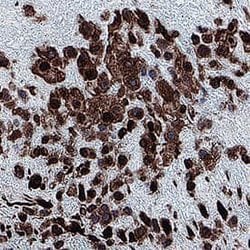 Human IL-15 Antibody, R D Systems:Antibodies:Primary Antibodies