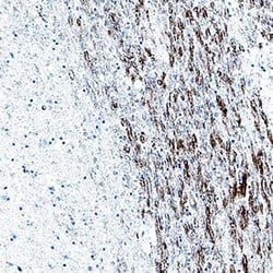 Human BDNF Antibody, R D Systems 100 &mu;g | Buy Online | R&D Systems | Fisher Scientific