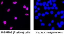 Human SOX9 Antibody, R D Systems 100 &mu;g | Buy Online | R&D Systems | Fisher Scientific