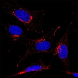 Mouse PDGF R alpha Antibody, R D Systems:Antibodies:Primary Antibodies