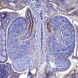 Mouse PDGF R alpha Antibody, R D Systems:Antibodies:Primary Antibodies