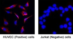 Human Endothelin-1 Antibody, R D Systems 25 &mu;g | Buy Online | R&D Systems | Fisher Scientific