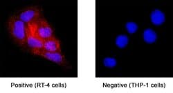 Human Cytokeratin 19 Antibody, R D Systems:Antibodies:Primary Antibodies