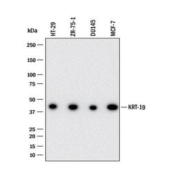 Human Cytokeratin 19 Antibody, R D Systems:Antibodies:Primary Antibodies