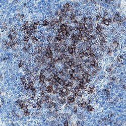 Human CD20 Antibody, R D Systems:Antibodies:Primary Antibodies