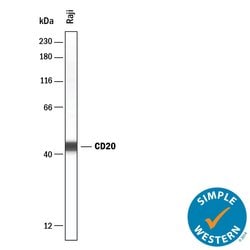 Human CD20 Antibody, R D Systems:Antibodies:Primary Antibodies