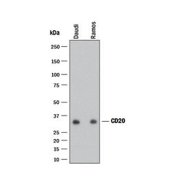 Human CD20 Antibody, R D Systems:Antibodies:Primary Antibodies