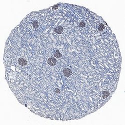 Human Nephrin Antibody, R D Systems:Antibodies:Primary Antibodies