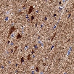 Human/Mouse Neuronal Pentraxin R/NPTXR Antibody, R D Systems:Antibodies:Primary