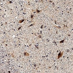 Human mGluR3 Antibody, R D Systems 100 &mu;g; Unconjugated:Antibodies,