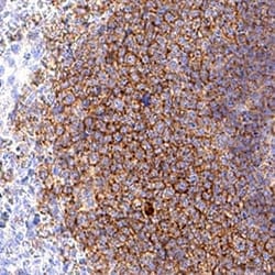 Human CD19 Antibody, R D Systems 25 &mu;g; Unconjugated:Antibodies, Monoclonal