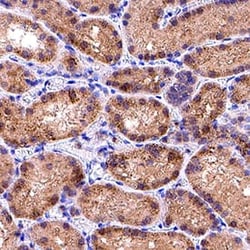 Human Adiponutrin/PNPLA3 Antibody, R D Systems 100 &mu;g; Unconjugated:Antibodies,