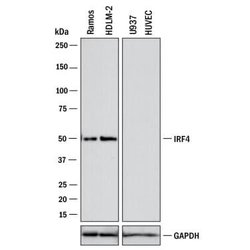 Human IRF4 Antibody, R D Systems:Antibodies:Primary Antibodies