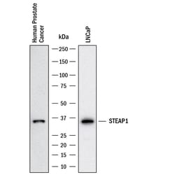 Human STEAP1 Antibody, R D Systems 25 &mu;g | Buy Online | R&D Systems | Fisher Scientific