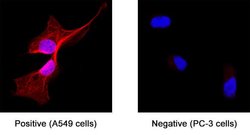 Human Androgen R/NR3C4 Isoform 2 Antibody, R D Systems 100 &mu;g; Unconjugated:Antibodies,