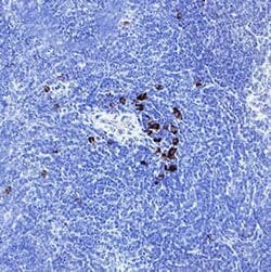 Mouse IL-12/IL-23 p40 Antibody, R D Systems:Antibodies:Primary Antibodies