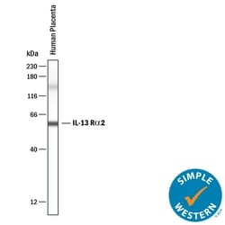 Human IL-13 R alpha 2 Antibody, R D Systems:Antibodies:Primary Antibodies