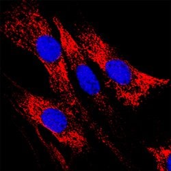 Human alpha-Galactosidase A/GLA Antibody, R D Systems 100 &mu;g; Unconjugated:Antibodies,
