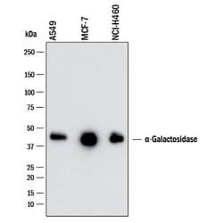 Human alpha-Galactosidase A/GLA Antibody, R D Systems 25 &mu;g; Unconjugated:Antibodies,