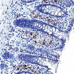 Human RANK/TNFRSF11A Antibody, R D Systems 25 &mu;g; Unconjugated:Antibodies,