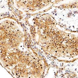 Human ATF6 Antibody, R D Systems 25 &mu;g; Unconjugated:Antibodies, Monoclonal