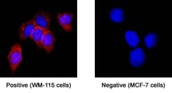 Human Lipoprotein Lipase/LPL Antibody, R D Systems 100 &mu;g; Unconjugated:Antibodies,
