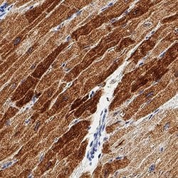 Human Lipoprotein Lipase/LPL Antibody, R D Systems 100 &mu;g; Unconjugated:Antibodies,