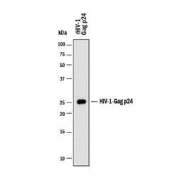 Viral HIV-1 Gag p24 Antibody, R D Systems:Antibodies:Primary Antibodies