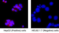 Human WFS1 Antibody, R D Systems:Antibodies:Primary Antibodies