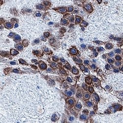 Human PlGF-3 Antibody, R D Systems:Antibodies:Primary Antibodies